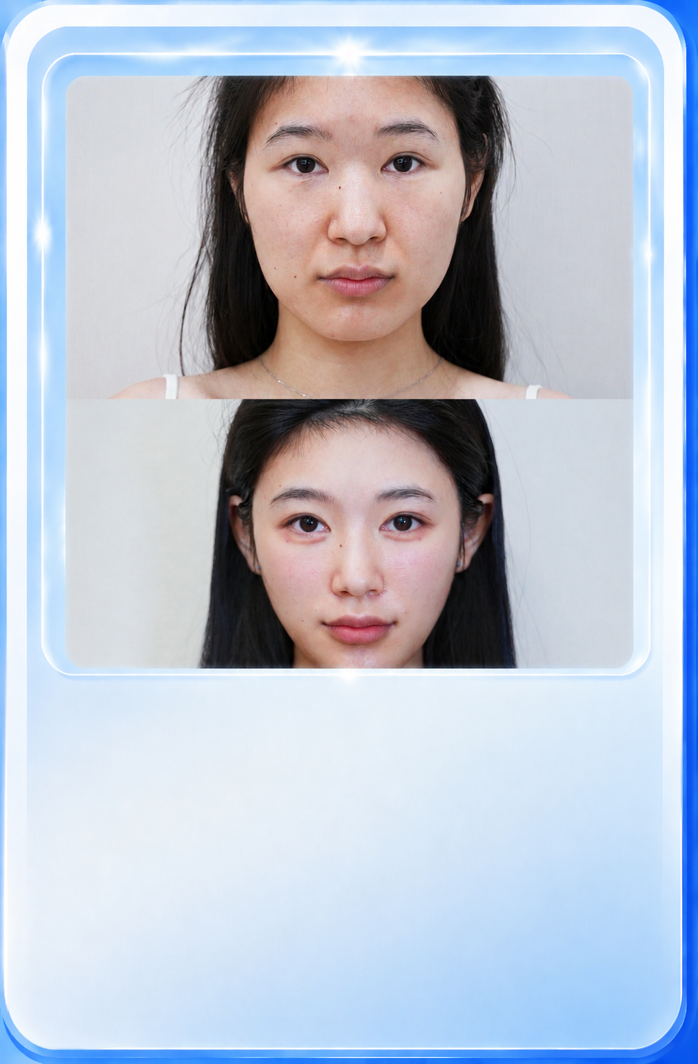Nâng cơ trẻ hóa toàn diện